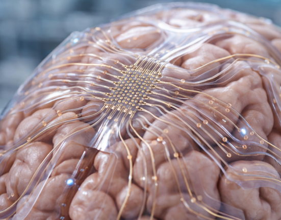 Soft Brain Implants: Merging BCI and Robotics for the Future